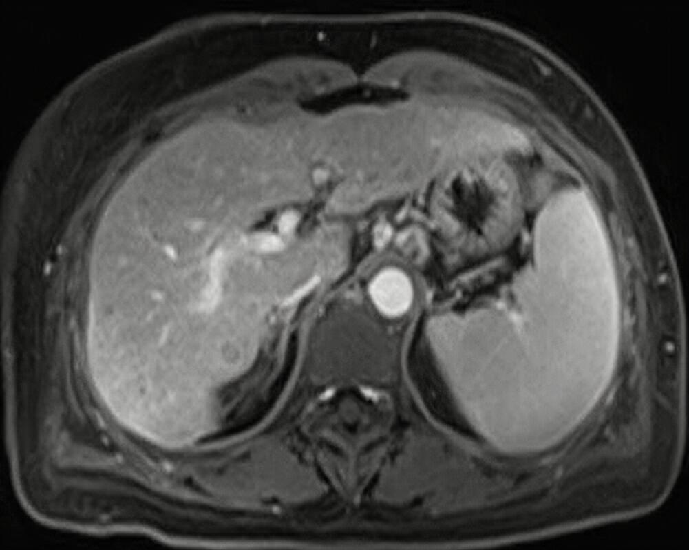 故事一.jpg 故事一.jpg